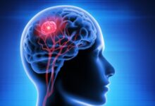 التهاب الدماغ.. تهديد صامت قد يقلب وظائف الجسم في لحظات رأسًا على عقب