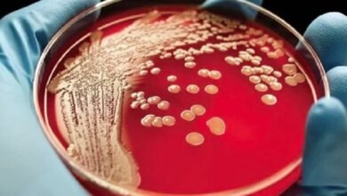 ليست للوقاية بل للعلاج.. خبير روسي يكشف أسرار اللقاح الذكي للقضاء على الخلايا السرطانية